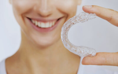 7 motivi per scegliere Invisalign per il tuo miglior sorriso