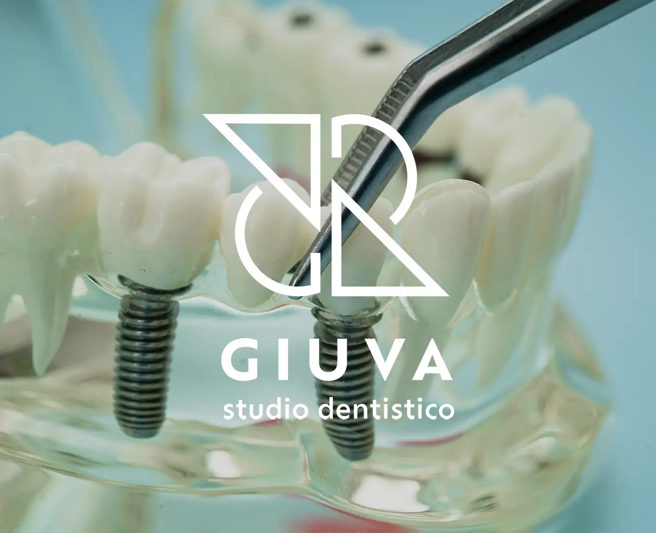 Perché scegliere lo Studio Dentistico Giuva Perché scegliere lo Studio Dentistico Giuva