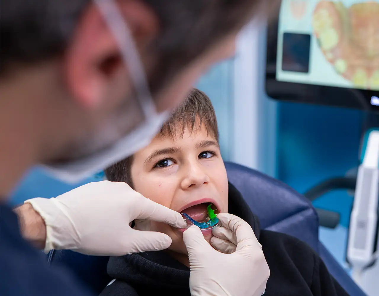 Apparecchi dentali - bambini - Studio Dentistico Giuva - Dentista Ostia