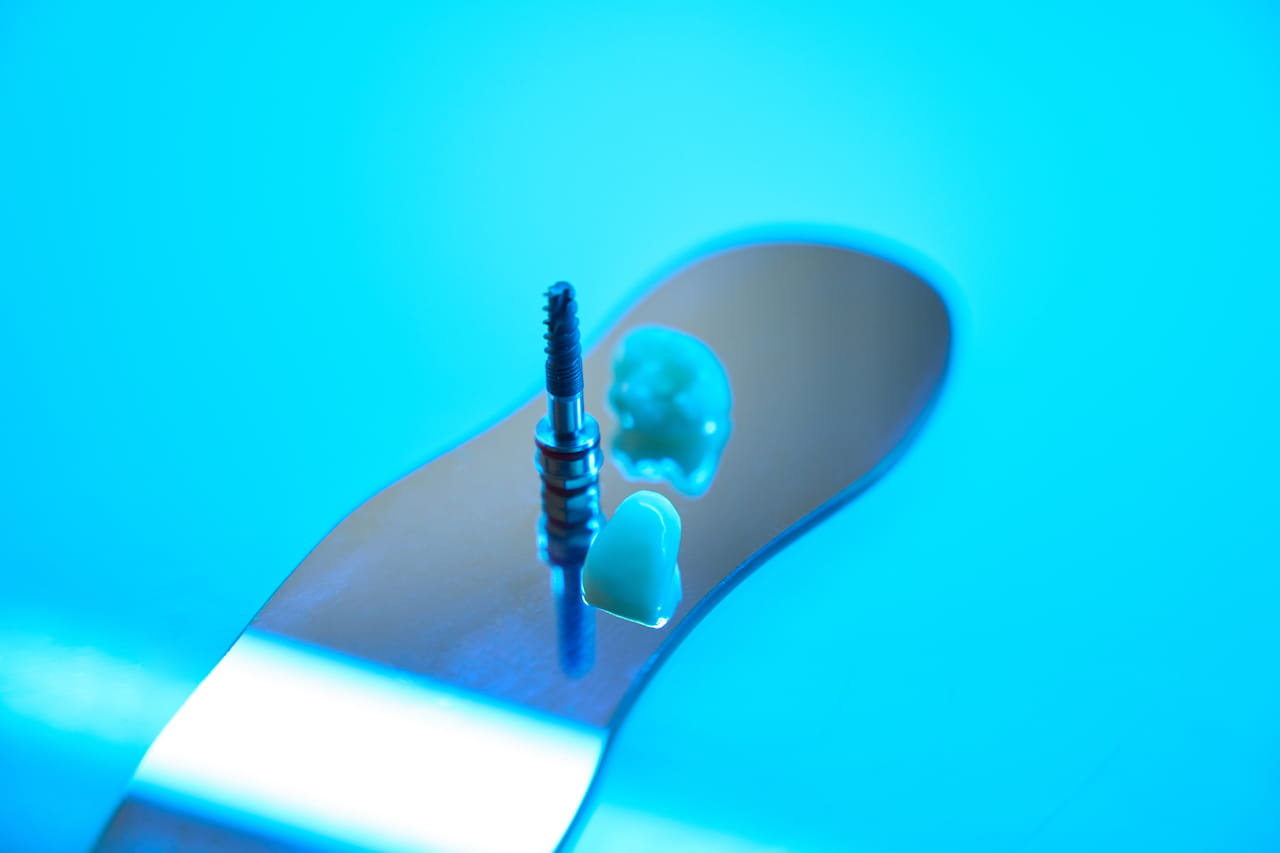 impianto dentale con capsula